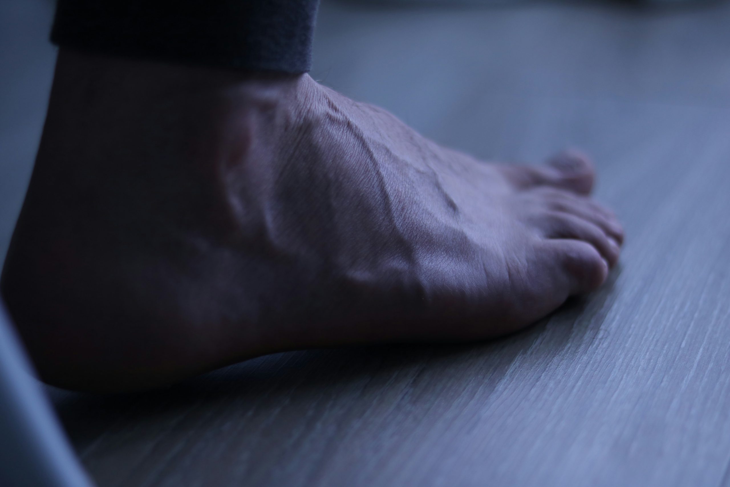 Diabetic foot and wound care in Garland & Wylie TX 