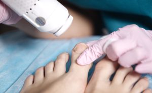 a podiatrist treats a patient's toenail with a laser